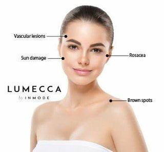 Lumecca IPL - Face, Neck and Chest (3) Treatments