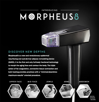 Morpheus8 - Face and Neck - Single Treatment